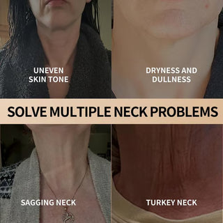 Neck & Eye Care Set – Tighten, Smooth & Hydrate ✨ All-in-One Moisturizing Treatment for Delicate Skin 💧